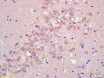 FIS1 Antibody in Immunohistochemistry (Paraffin) (IHC (P))