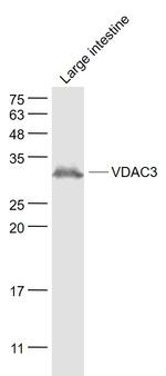 VDAC3 Antibody in Western Blot (WB)