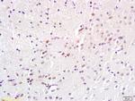 Adenovirus 5 E1A binding protein Antibody in Immunohistochemistry (Paraffin) (IHC (P))