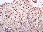 Sororin Antibody in Immunohistochemistry (Paraffin) (IHC (P))