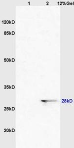 Sororin Antibody in Western Blot (WB)