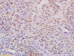 WAPL Antibody in Immunohistochemistry (Paraffin) (IHC (P))