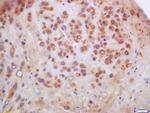 Anillin Antibody in Immunohistochemistry (Paraffin) (IHC (P))