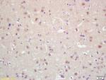 MKLP2 Antibody in Immunohistochemistry (Paraffin) (IHC (P))