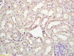 MKLP2 Antibody in Immunohistochemistry (Paraffin) (IHC (P))