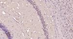 NUSAP1 Antibody in Immunohistochemistry (Paraffin) (IHC (P))