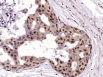 RAB35 Antibody in Immunohistochemistry (Paraffin) (IHC (P))