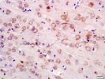 NEDD4 Antibody in Immunohistochemistry (Paraffin) (IHC (P))