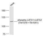 Phospho-LATS1 (Thr1079) Antibody in Western Blot (WB)