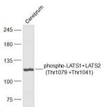Phospho-LATS1 (Thr1079) Antibody in Western Blot (WB)