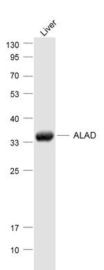 ALAD Antibody in Western Blot (WB)