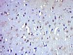 ICMT Antibody in Immunohistochemistry (Paraffin) (IHC (P))