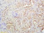 PLEKHM2 Antibody in Immunohistochemistry (Paraffin) (IHC (P))