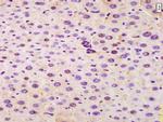 SRRM2 Antibody in Immunohistochemistry (Paraffin) (IHC (P))