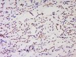 NSD1 Antibody in Immunohistochemistry (Paraffin) (IHC (P))