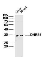 DHRS4 Antibody in Western Blot (WB)