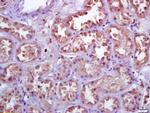 TXNRD1 Antibody in Immunohistochemistry (Paraffin) (IHC (P))