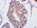 TXNRD1 Antibody in Immunohistochemistry (Paraffin) (IHC (P))