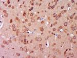 TXNRD1 Antibody in Immunohistochemistry (Paraffin) (IHC (P))