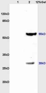 TXNRD1 Antibody in Western Blot (WB)