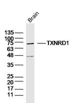 TXNRD1 Antibody in Western Blot (WB)