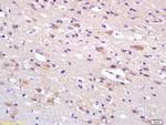 HIP2 Antibody in Immunohistochemistry (Paraffin) (IHC (P))