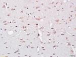 UBE2Q1 Antibody in Immunohistochemistry (Paraffin) (IHC (P))