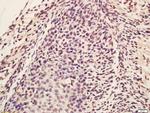 Lin28A/B Antibody in Immunohistochemistry (Paraffin) (IHC (P))