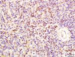 FCER1A Antibody in Immunohistochemistry (Paraffin) (IHC (P))