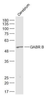 GABR B3 Antibody in Western Blot (WB)