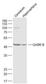 GABR B3 Antibody in Western Blot (WB)