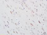 Nitrotyrosine Antibody in Immunohistochemistry (Paraffin) (IHC (P))