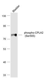 Phospho-CPLA2 (Ser505) Antibody in Western Blot (WB)