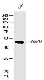 C9orf72 Antibody in Western Blot (WB)