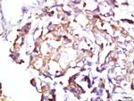 BDKRB1 Antibody in Immunohistochemistry (Paraffin) (IHC (P))