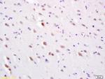 SLC30A3 Antibody in Immunohistochemistry (Paraffin) (IHC (P))