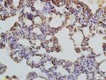 LC3 Antibody in Immunohistochemistry (Paraffin) (IHC (P))