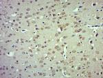 TRPM4 Antibody in Immunohistochemistry (Paraffin) (IHC (P))