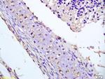 Phospho-DVL2 (Thr224) Antibody in Immunohistochemistry (Paraffin) (IHC (P))