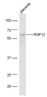 RNF12 Antibody in Western Blot (WB)