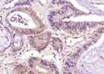 CDX2/3 Antibody in Immunohistochemistry (Paraffin) (IHC (P))