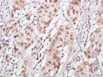 FOG1 Antibody in Immunohistochemistry (Paraffin) (IHC (P))