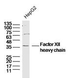 Factor 12 heavy chain Antibody in Western Blot (WB)