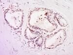 POLR3C Antibody in Immunohistochemistry (Paraffin) (IHC (P))