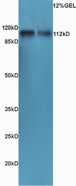 ATP1A1 Antibody in Western Blot (WB)