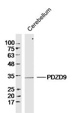 PDZD9 Antibody in Western Blot (WB)