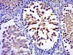 C17orf75 Antibody in Immunohistochemistry (Paraffin) (IHC (P))