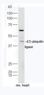 E3 ubiquitin ligase Antibody in Western Blot (WB)