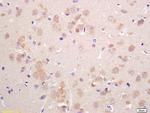 VGLUT2 Antibody in Immunohistochemistry (Paraffin) (IHC (P))