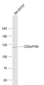 C20orf194 Antibody in Western Blot (WB)